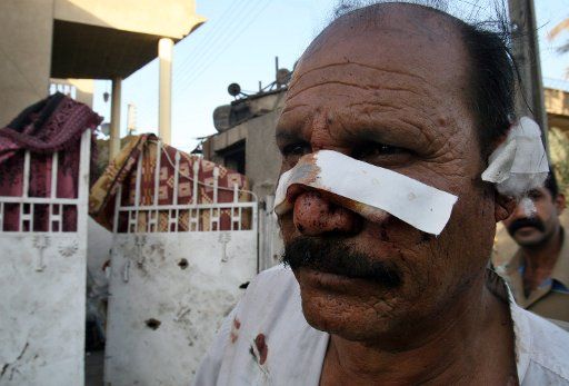 An Iraqi man injured by a truck bomb walks in the Ash ShaÕb neighborhood in Baghdad on June 4 2008. A suicide truck bomb detonated outside the home of an Iraqi police general killing 16 and wounding 50 others. This was the deadliest single attack ...