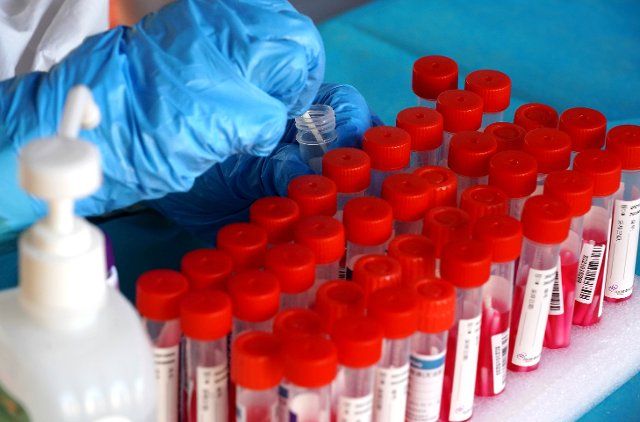 (210802) -- ZHENGZHOU, Aug. 2, 2021 (Xinhua) -- A medical worker takes a swab sample for nucleic acid test in Zhengzhou, central China\